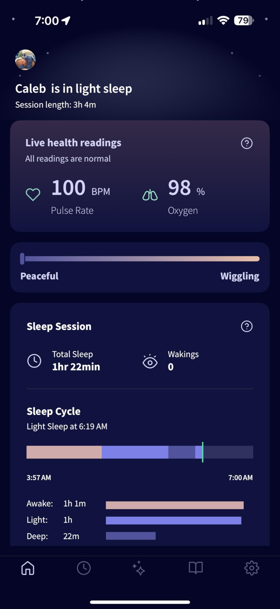Owlet Dream Sock Smart Baby Monitor, Better Sleep for Baby & You customer photo 1