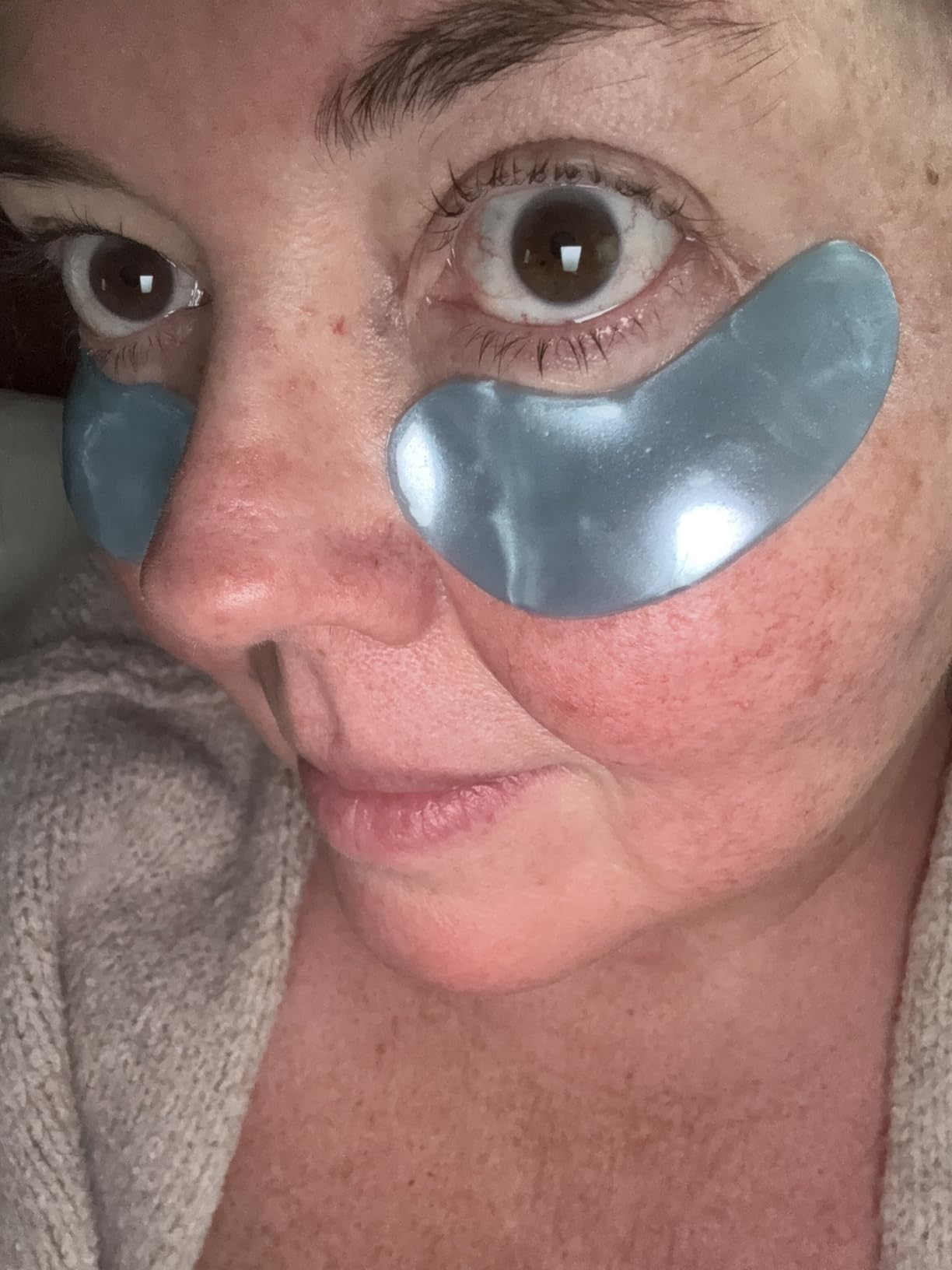 grace & stella Award Winning Eye Patches for Puffy Eyes customer photo 2