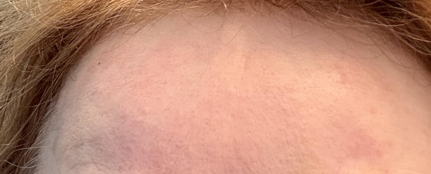 The Ordinary Hyaluronic Acid 2% + B5 (with Ceramides), Multi-Depth Hydration Serum for Plumper, Smoother Skin customer photo 1