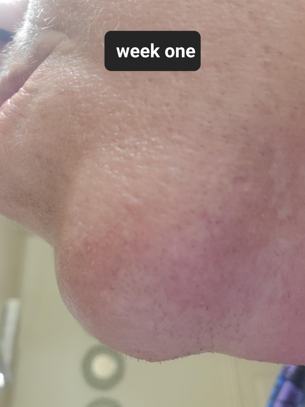 SmoothSkin Pure Fit IPL Hair Removal Device – At-Home Laser Hair Removal for Women & Men, Visible Results in 2 Weeks, Includes Precision Head, Safe for Face & Body, Long-Lasting Hair Reduction customer photo 2